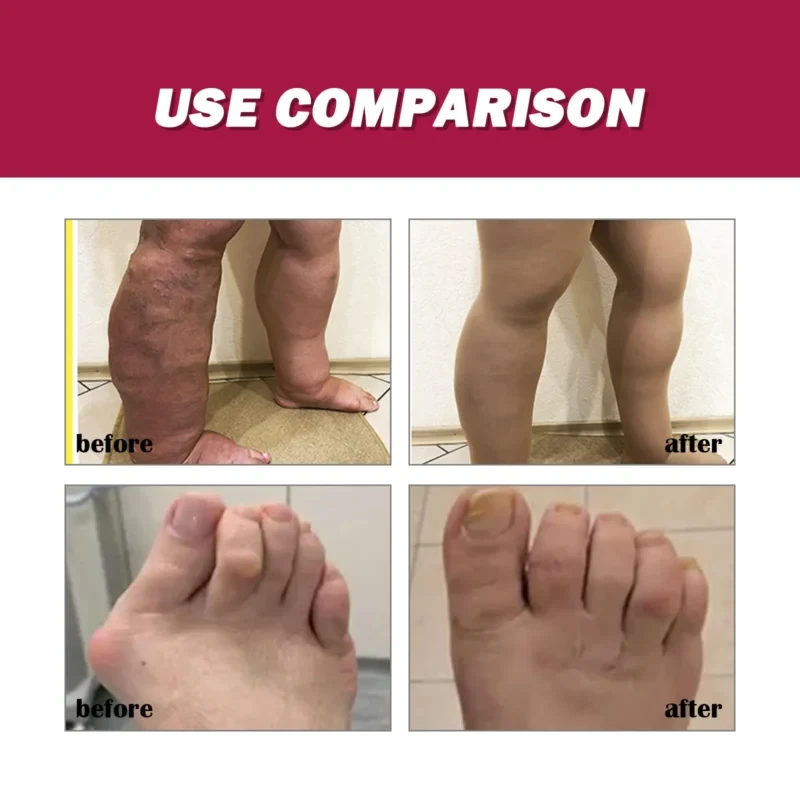 First slide
